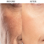 Anti Aging Infusion Solution