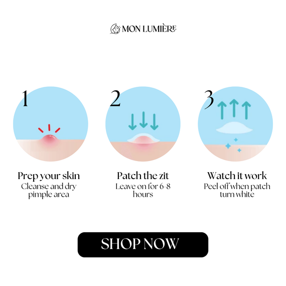 Hydrocolloid Acne Patch image-3